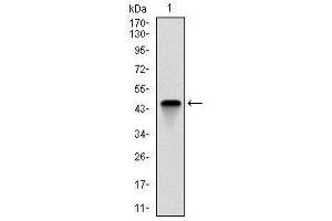 TNNI2 antibody