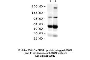 Image no. 2 for anti-BRCA1 Interacting Protein C-terminal Helicase 1 (BRIP1) (C-Term) antibody (ABIN363341)