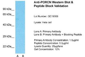 Image no. 3 for anti-Porcupine Homolog (PORCN) (N-Term) antibody (ABIN2783888)