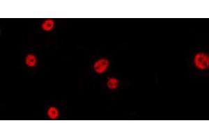 Image no. 2 for anti-Cell Division Cycle 40 (CDC40) antibody (ABIN6258463)