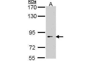 BBS12 antibody  (Center)