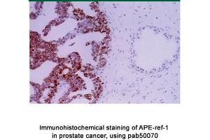 Image no. 2 for anti-Apurinic/Apyrimidinic Endonuclease 1 (APEX1) antibody (ABIN363379)