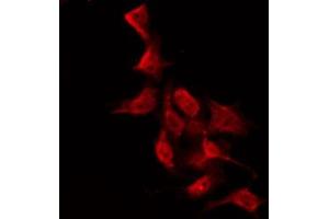Image no. 1 for anti-Protein Kinase C, zeta (PRKCZ) (pThr560) antibody (ABIN6256579)