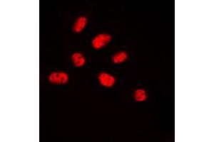 Image no. 1 for anti-Solute Carrier Family 6 (Neurotransmitter Transporter, Noradrenalin), Member 2 (SLC6A2) (C-Term), (pSer357) antibody (ABIN2705031)