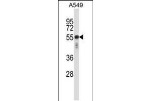 Image no. 1 for anti-Keratin 6C (KRT6C) (AA 135-164), (N-Term) antibody (ABIN5535098)