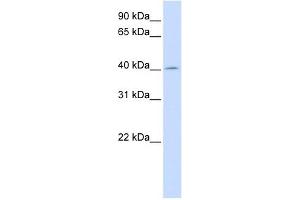 Image no. 1 for anti-Acetyl-CoA Acyltransferase 2 (ACAA2) (N-Term) antibody (ABIN631066)