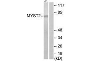 Image no. 1 for anti-MYST Histone Acetyltransferase 2 (MYST2) (AA 131-180) antibody (ABIN1533558)