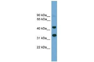 anti-Forkhead Box I2 (FOXI2) (N-Term) antibody