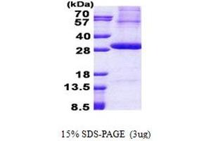 Image no. 1 for Kallikrein 2 (KLK2) (AA 25-261) protein (His tag) (ABIN5853050)