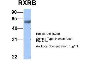 Retinoid X Receptor beta Antikörper  (N-Term)