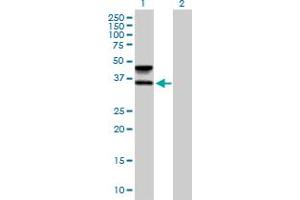 Image no. 1 for anti-Fucosyltransferase 6 (Alpha (1,3) Fucosyltransferase) (FUT6) (AA 1-359) antibody (ABIN515862)