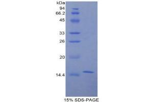 Image no. 1 for Galactosylceramidase (GALC) (AA 38-156) protein (His tag) (ABIN1878884)