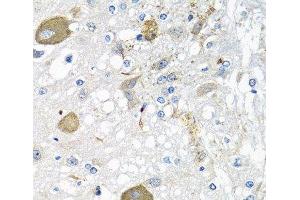 Immunohistochemistry of paraffin-embedded Rat brain using IFNL3 Polyclonal Antibody at dilution of 1:100 (40x lens).