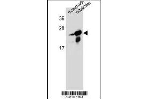 Image no. 1 for anti-RAB25, Member RAS Oncogene Family (RAB25) (AA 113-141) antibody (ABIN5531991)