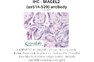 Image no. 1 for anti-MAGE-Like 2 (MAGEL2) (AA 514-529) antibody (ABIN1736685)