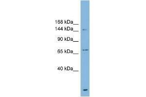 Image no. 1 for anti-ATP-Binding Cassette, Sub-Family B (MDR/TAP), Member 1 (ABCB1) (Middle Region) antibody (ABIN2773986)
