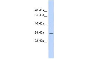 Image no. 1 for anti-Regulatory Factor X-Associated Protein (RFXAP) (Middle Region) antibody (ABIN2777814)