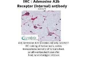 Image no. 1 for anti-Adenosine A2b Receptor (ADORA2B) (Internal Region) antibody (ABIN1731551)