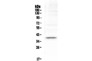 Image no. 1 for anti-T-Cell Acute Lymphocytic Leukemia 1 (TAL1) (AA 174-259) antibody (ABIN5693282)