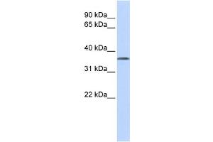 Image no. 4 for anti-Tissue Specific Transplantation Antigen P35B (TSTA3) (N-Term) antibody (ABIN2787788)