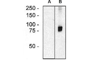 Western blotting analysis of ARHGEF4 in HEK293 cells (A) and HEK293-ARHGEF4 transfectants (B) using mouse monoclonal anti-ARHGEF4 (clone ARHGEF-08).