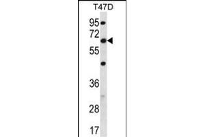 FAM83D 抗体  (C-Term)