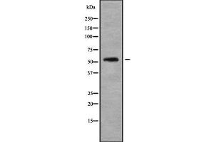 Image no. 2 for anti-RasGEF Domain Family, Member 1B (RASGEF1B) (C-Term) antibody (ABIN6264648)
