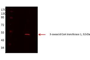 Image no. 3 for anti-3-Oxoacid CoA Transferase 1 (OXCT1) (Middle Region) antibody (ABIN2783388)