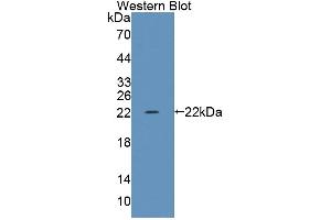 Image no. 1 for anti-Transcriptional Regulating Factor 1 (TRERF1) (AA 785-942) antibody (ABIN5014435)