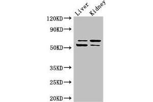 Western Blot Positive WB detected in: Mouse liver tissue, Mouse kidney tissue All lanes: LMBRD1 antibody at 4 μg/mL Secondary Goat polyclonal to rabbit IgG at 1/50000 dilution Predicted band size: 62, 45, 54, 22 kDa Observed band size: 62, 54 kDa