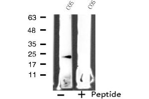 Image no. 3 for anti-Mitochondrial Ribosomal Protein L11 (MRPL11) (Internal Region) antibody (ABIN6257350)