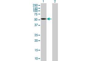 Western Blot analysis of SNX17 expression in transfected 293T cell line by SNX17 MaxPab polyclonal antibody.