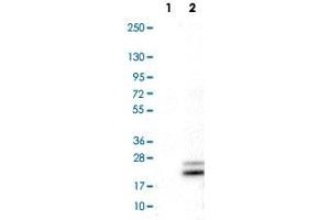 Image no. 1 for anti-Ribonuclease, RNase A Family, 7 (RNASE7) antibody (ABIN5650184)