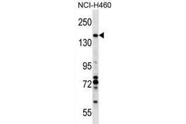 anti-Valosin Containing Protein (p97)/p47 Complex Interacting Protein 1 (Vcpip1) (AA 123-151), (N-Term) antibody