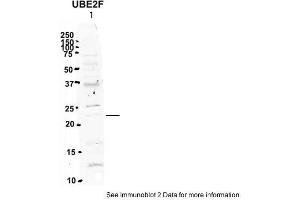 Image no. 2 for anti-Ubiquitin-Conjugating Enzyme E2F (UBE2F) (N-Term) antibody (ABIN2784961)