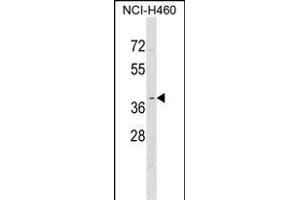 OR2Y1 antibody  (C-Term)