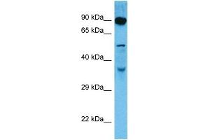 Host:  Rat  Target Name:  DMTF1  Sample Tissue:  Rat Skeletal Muscle  Antibody Dilution:  1ug/ml