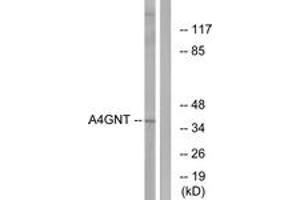 Image no. 1 for anti-alpha-1,4-N-Acetylglucosaminyltransferase (A4GNT) (AA 31-80) antibody (ABIN1534622)