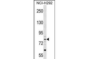 CRTAC1 Antibody (N-term) (ABIN1539011 and ABIN2849583) western blot analysis in NCI- cell line lysates (35 μg/lane).