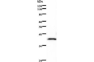 Image no. 1 for anti-MDS1 and EVI1 Complex Locus (MECOM) antibody (ABIN930875)