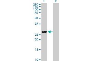 anti-Four and A Half LIM Domains 2 (FHL2) (AA 1-279) antibody
