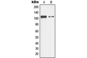Image no. 1 for anti-Mitogen-Activated Protein Kinase Kinase Kinase 13 (MAP3K13) (Center) antibody (ABIN2706495)