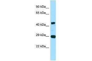 Image no. 1 for anti-Actin, gamma 2, Smooth Muscle, Enteric (ACTG2) (C-Term) antibody (ABIN2790240)