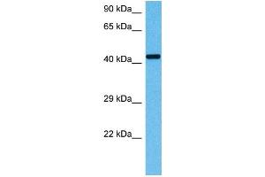 Image no. 5 for anti-Ornithine Aminotransferase (OAT) (Middle Region) antibody (ABIN2783233)