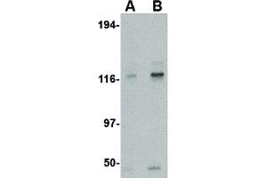 Image no. 2 for anti-Kinesin Family Member 5A (KIF5A) (Internal Region) antibody (ABIN6656248)
