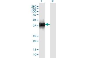 Image no. 2 for anti-Surfactant Protein B (SFTPB) (AA 1-381) antibody (ABIN2565888)