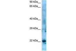 Image no. 1 for anti-Synovial Sarcoma, X Breakpoint 5 (SSX5) (AA 119-168) antibody (ABIN6748426)