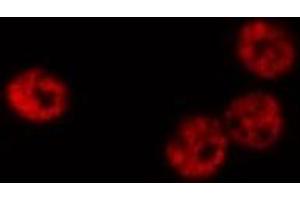 Image no. 3 for anti-Heterogeneous Nuclear Ribonucleoprotein C (C1/C2) (HNRNPC) antibody (ABIN6262318)