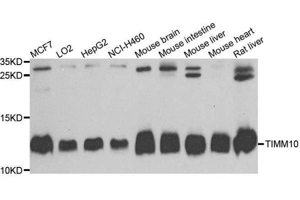 TIMM10 antibody  (AA 1-90)