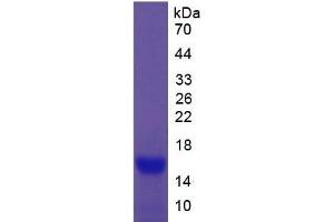 Image no. 3 for Carcinoembryonic Antigen Gene Family (CEA) ELISA Kit (ABIN6730922)